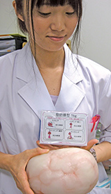 臨床栄養臨地実習